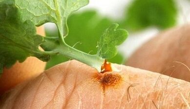 Como conseguir uma verruga com uma Celandine