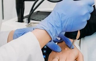 maneiras de remover verrugas