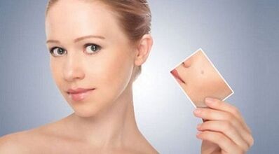 revisão de remédios eficazes para verrugas e papilomas