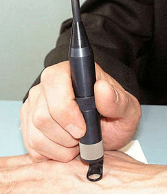 Tratamento de Papilloma